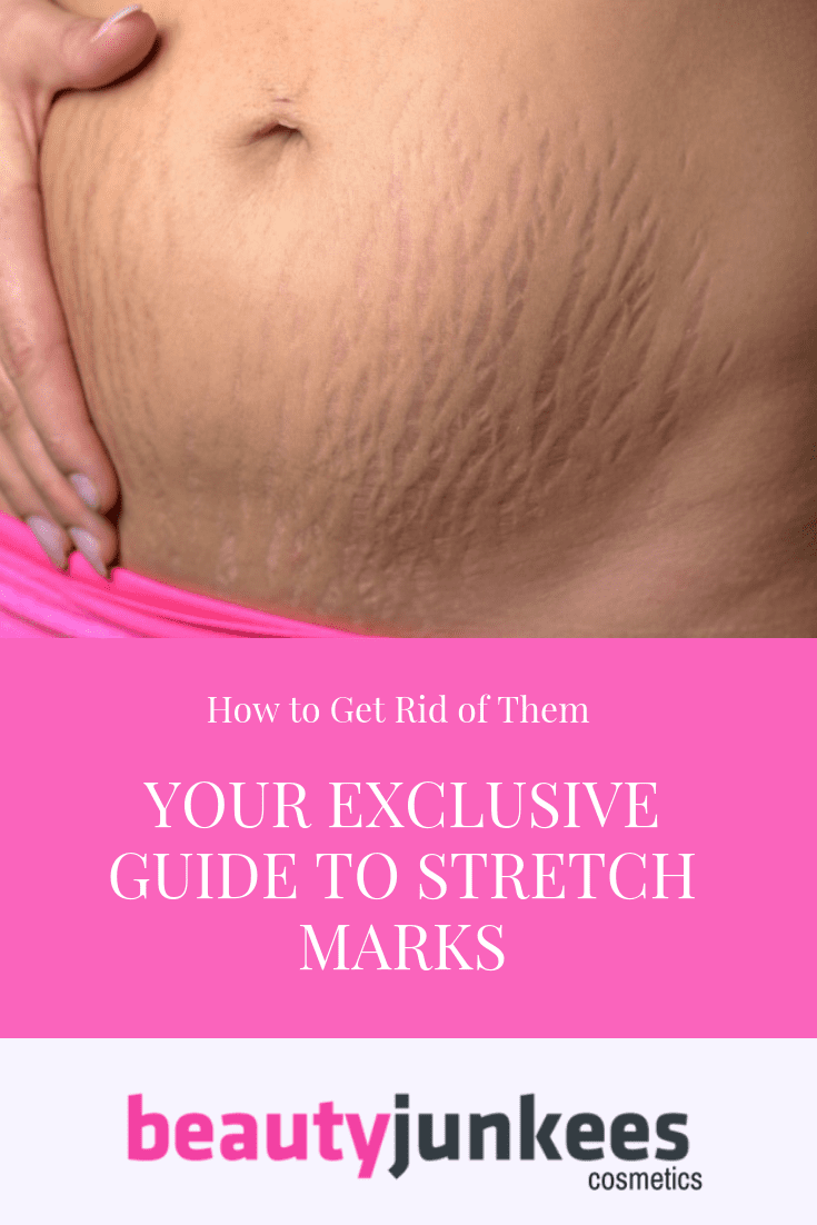 Why Women Get Stretch Markss On Their Ass